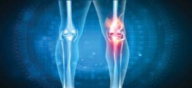 Most Common Symptoms And Causes Of Arthritis