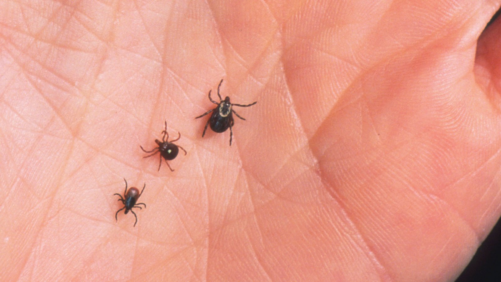 Lyme Disease: What To Eat And What To Avoid - A Complete Diet