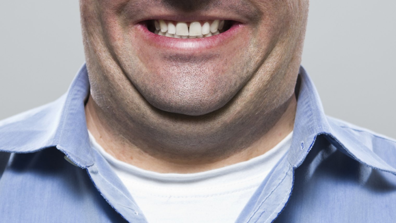 Is It Possible To Lose Your Double Chin By Diet?