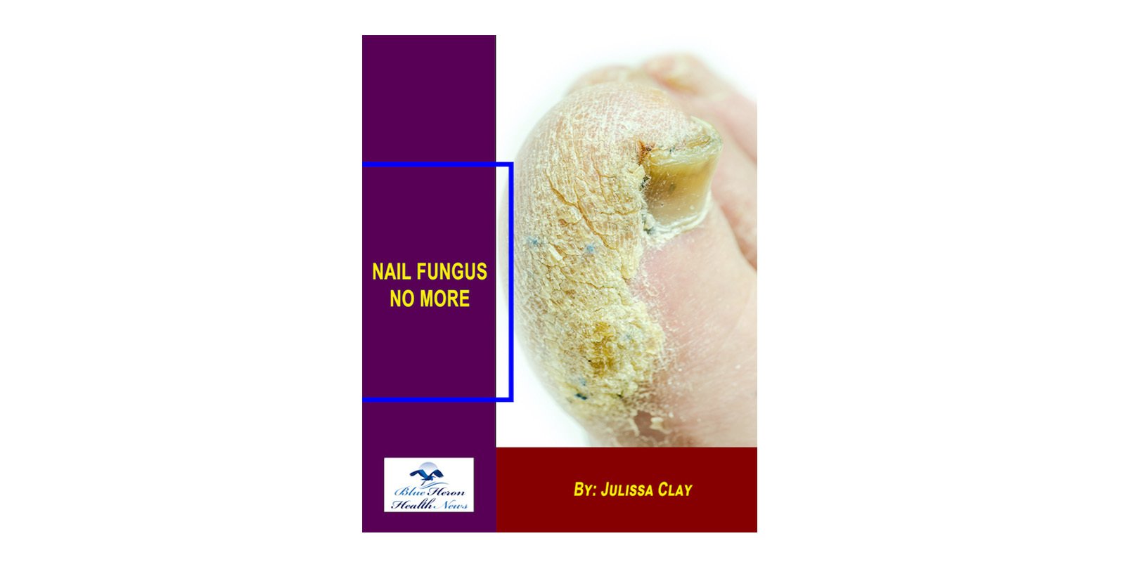 Nail Fungus No More Reviews